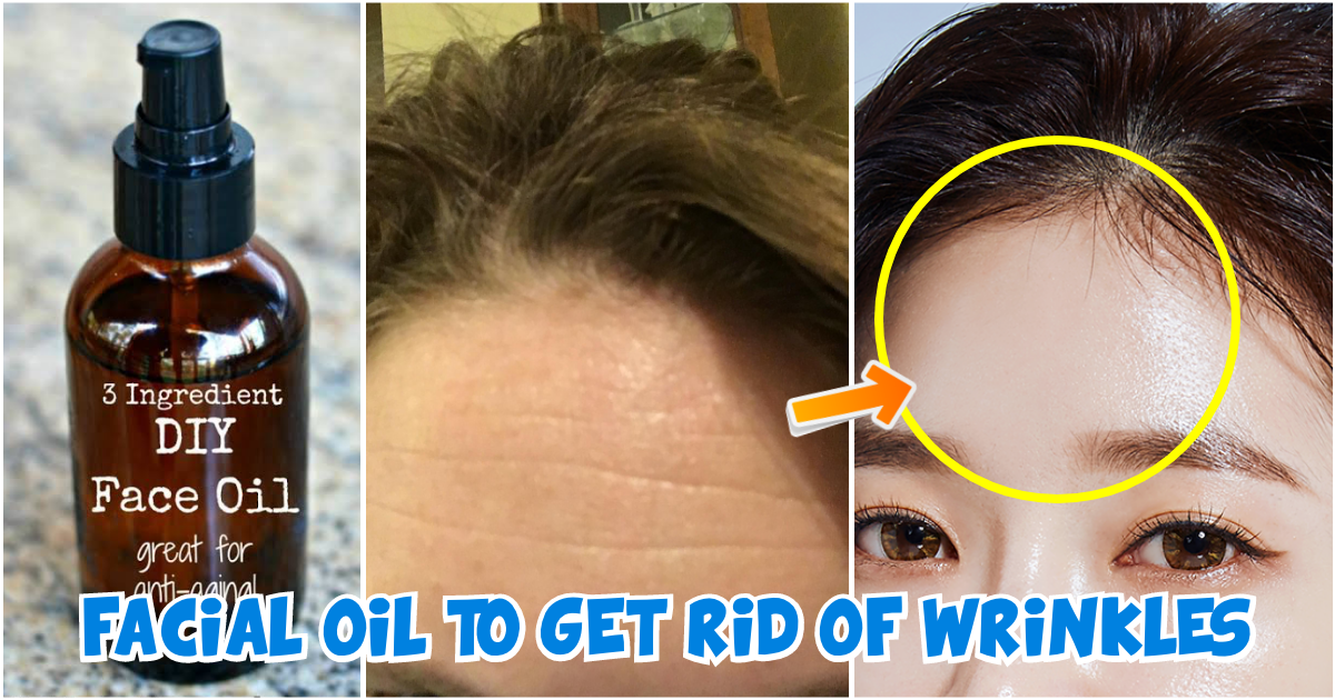 15 Habits That Cause Wrinkles and Premature Ageing