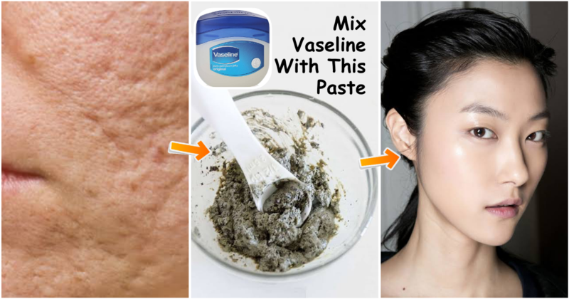 7 Substances in Skincare to Keep away from For those who Have Dry Pores and skin